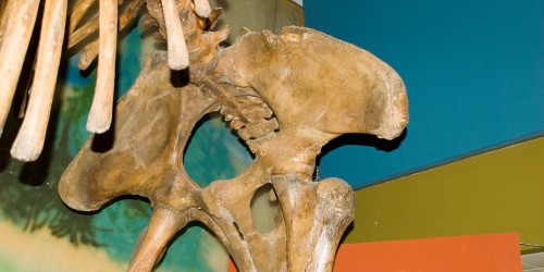 Causes of pelvic pain in women