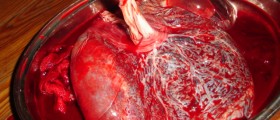 Interesting facts about your placenta