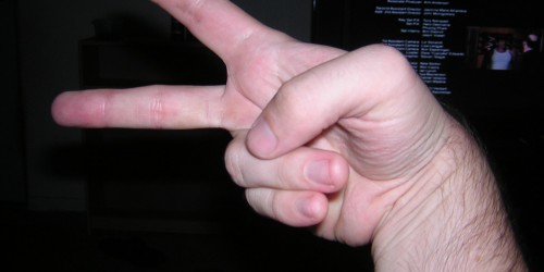 Thoughts on routine infant circumcision