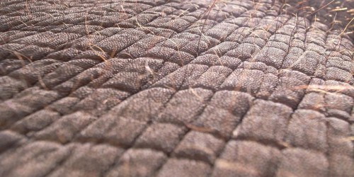 Think You've Got Melasma? What You Need To Know About Treatment