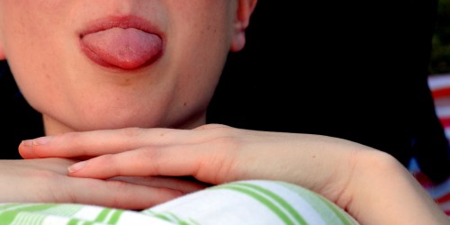 Hairy Tongue, Geographic Tongue, And Other Common Tongue Malformations