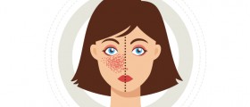 Fibromyalgia And Lupus: Is There Any Hope For A Pain-Free Life?