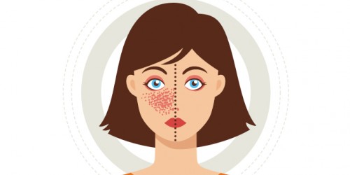 Fibromyalgia And Lupus: Is There Any Hope For A Pain-Free Life?