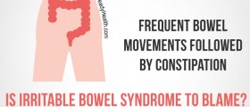 Frequent Bowel Movements Followed by Constipation: Is Irritable Bowel Syndrome to Blame?