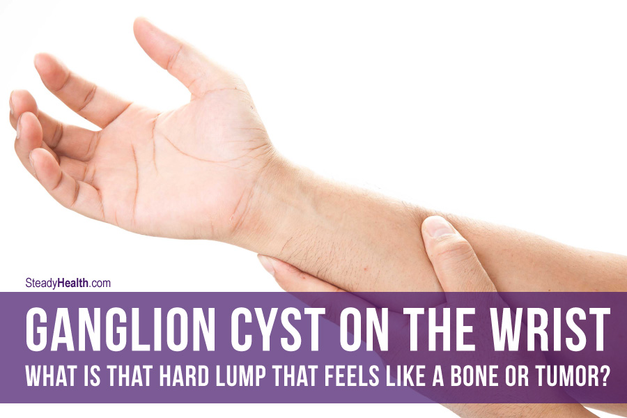Ganglion Cyst On The Wrist: What Is That Hard Lump That Feels Like a