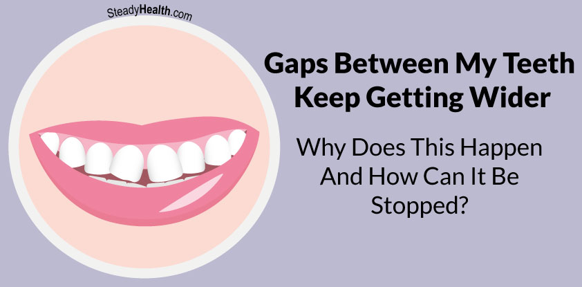 why teeth between gaps does keep getting happen gap wider stopped nose ear throat steadyhealth articles increasing