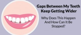 Gaps Between My Teeth Keep Getting Wider: Why Does This Happen And How Can It Be Stopped?