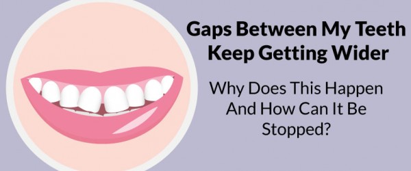 gaps stopped steadyhealth