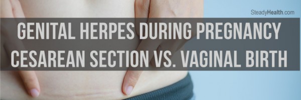Genital Herpes During Pregnancy: Cesarean Section Vs. Vaginal Birth