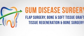 Gum Disease Surgery: Flap Surgery, Bone And Soft Tissue Grafts, Tissue Regeneration And Bone Surgery