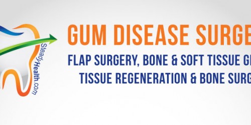 Gum Disease Surgery: Flap Surgery, Bone And Soft Tissue Grafts, Tissue Regeneration And Bone Surgery