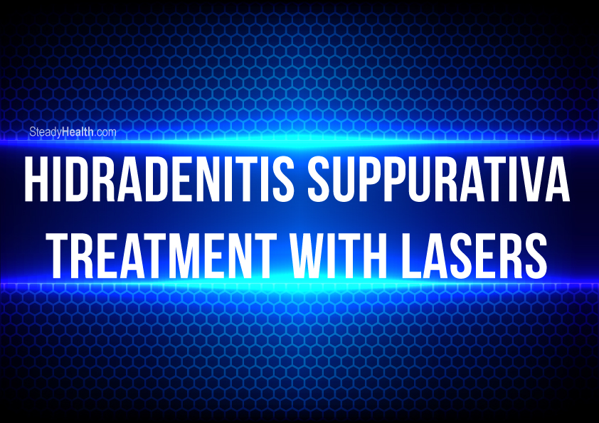 Hidradenitis Suppurativa Treatment With Lasers A Newer Approach To