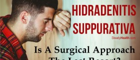 Hidradenitis Suppurativa Treatment With Surgery: Is A Surgical Approach The Last Resort?