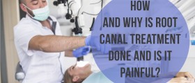 How And Why Is Root Canal Treatment Done And Is It Painful?