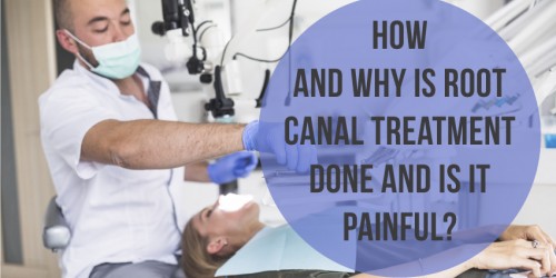 How And Why Is Root Canal Treatment Done And Is It Painful?