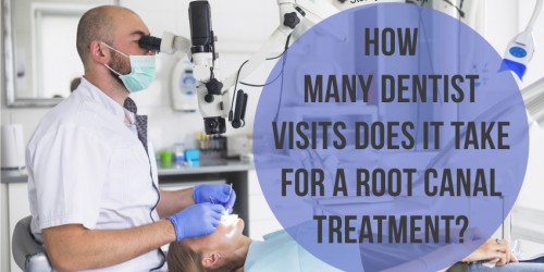 How Many Dentist Visits Does It Take For A Root Canal Treatment? Can It Be Done In One One Sitting?