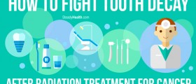 How To Fight Tooth Decay After Radiation Treatment For Cancer