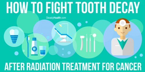 How To Fight Tooth Decay After Radiation Treatment For Cancer