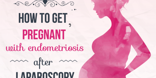 How To Get Pregnant With Endometriosis After Laparoscopy