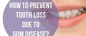 How To Prevent Tooth Loss Due To Gum Disease?
