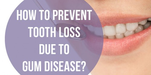 How To Prevent Tooth Loss Due To Gum Disease?