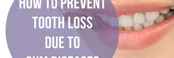 How To Prevent Tooth Loss Due To Gum Disease?