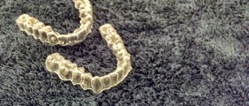 Everything You Wanted To Know About Invisalign