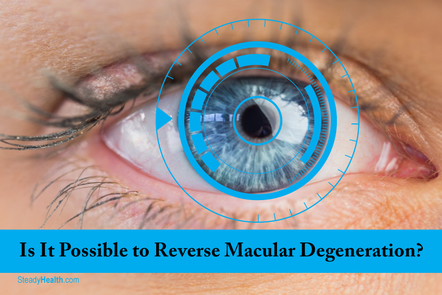 Is It Possible To Reverse Macular Degeneration 