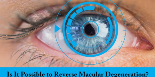Is It Possible to Reverse Your Macular Degeneration?
