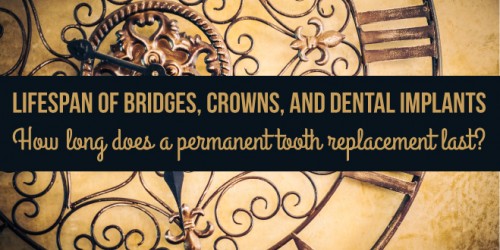 Lifespan Of Bridges, Crowns, And Dental Implants: How Long Does A Permanent Tooth Replacement Last?