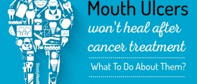 Mouth Ulcers Won't Heal After Cancer Treatment: What To Do About Them?