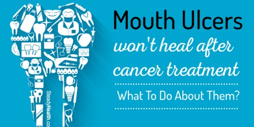 Mouth Ulcers Won't Heal After Cancer Treatment: What To Do About Them?