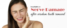 Nerve Damage After Wisdom Tooth Removal