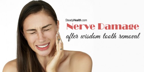 Nerve Damage After Wisdom Tooth Removal