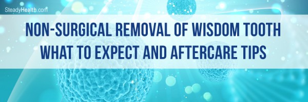 Non-Surgical Removal Of Wisdom Tooth: What To Expect And Aftercare Tips