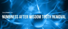 Numbness After Wisdom Tooth Removal: What Now?