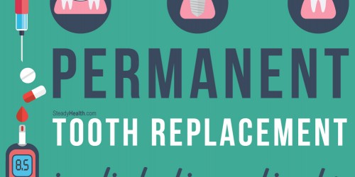Permanent Tooth Replacement In Diabetic Patients