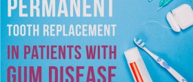 Permanent Tooth Replacement In Patients With Gum Disease