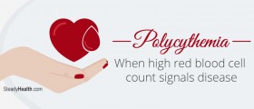 Polycythemia: When High Red Blood Cell Count Signals Disease