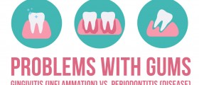 Problems With Gums: Gingivitis (Gum Inflammation) vs. Periodontitis (Gum Disease)