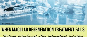 Retinal Detachment after Intravitreal Injection: When Macular Degeneration Treatment Fails