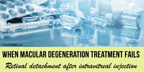 Retinal Detachment after Intravitreal Injection: When Macular Degeneration Treatment Fails