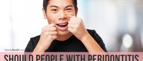 Should People With Peridontitis Floss Their Teeth?