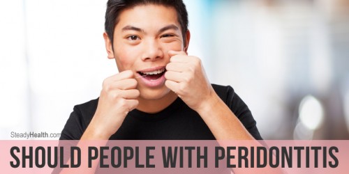 Should People With Peridontitis Floss Their Teeth?