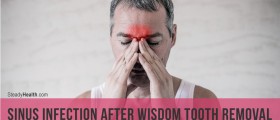 Sinus Infection After Wisdom Tooth Removal