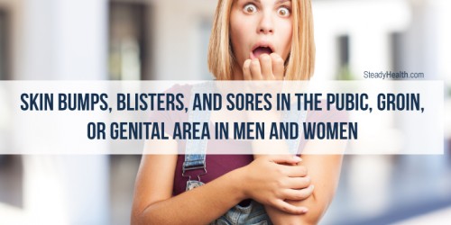 Skin Bumps, Blisters, And Sores In The Pubic, Groin, Or Genital Area In Men And Women