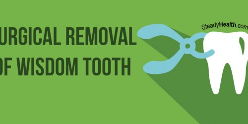 Surgical Removal Of Wisdom Tooth: What To Expect And Aftercare Tips