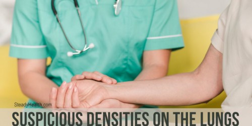 Suspicious Densities On The Lungs: A Sign Of Angina Pectoris?