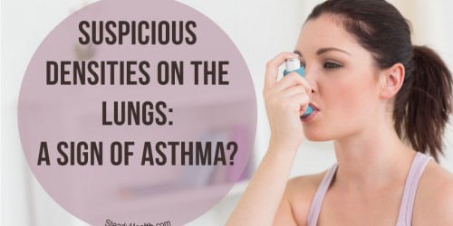 Suspicious Densities On The Lungs: A Sign Of Asthma?