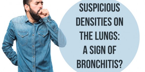 Suspicious Densities On The Lungs: A Sign Of Bronchitis?